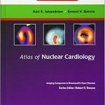 Atlas of Nuclear Cardiology: Imaging Companion to Braunwald’s Heart Disease: Expert Consult