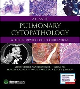 Atlas of Pulmonary Cytopathology Ebook