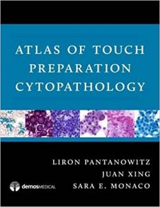 Atlas of Touch Preparation Cytopathology Ebook