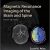 <span itemprop="name">Magnetic Resonance Imaging of the Brain and Spine Fifth Edition Ebook</span>